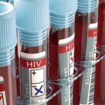 New Test Can Detect Hiv Virus Within A Week Of Infection