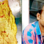 Pune: Sassoon Hospital probes man's death after mop was left in his stomach